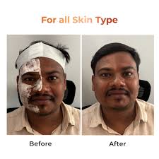 Niconi Whitening Cream Unisex